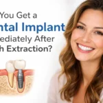 dental implants near me