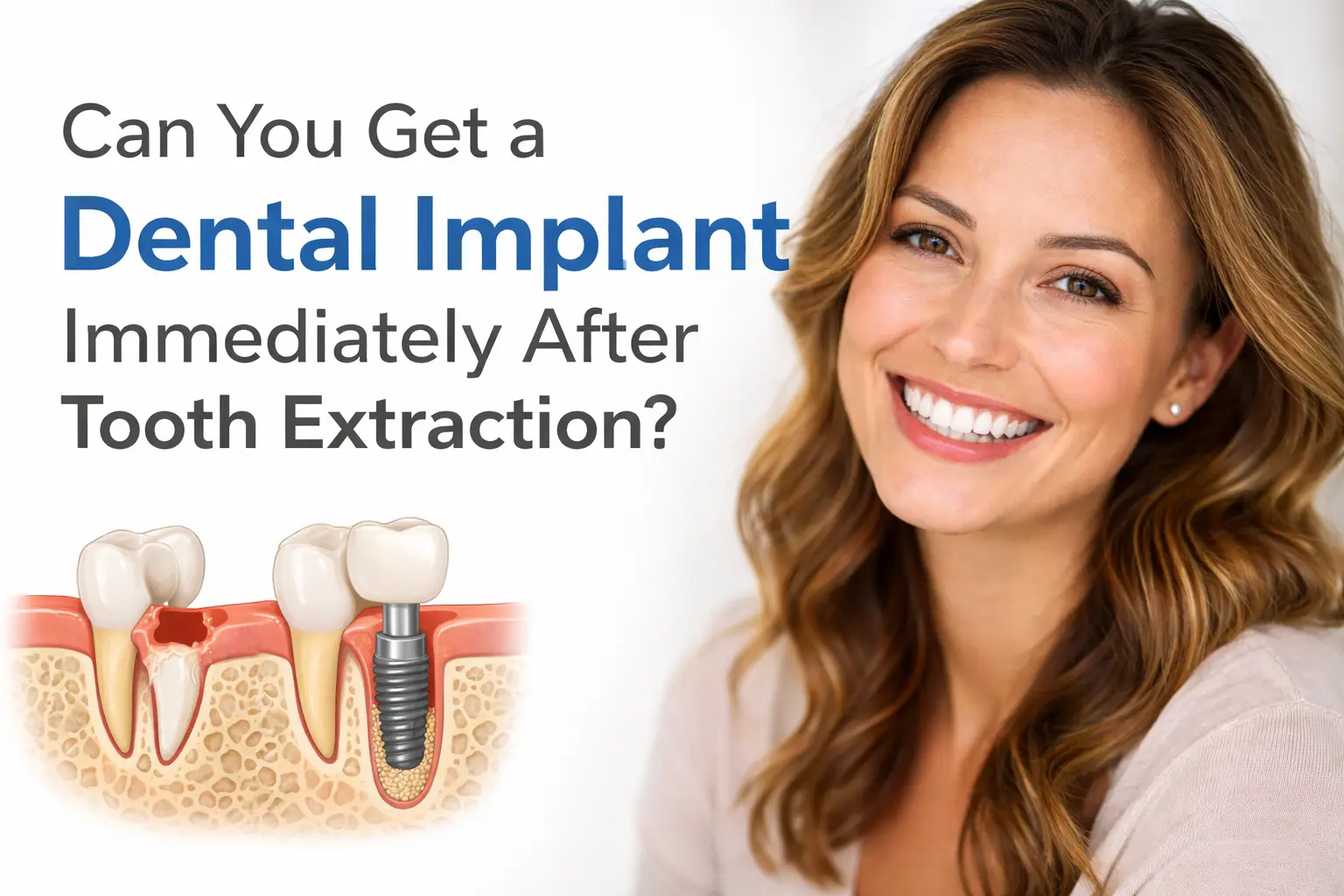 dental implants near me