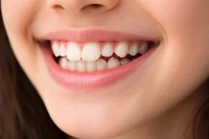crowded teeth in children – does my child need braces"